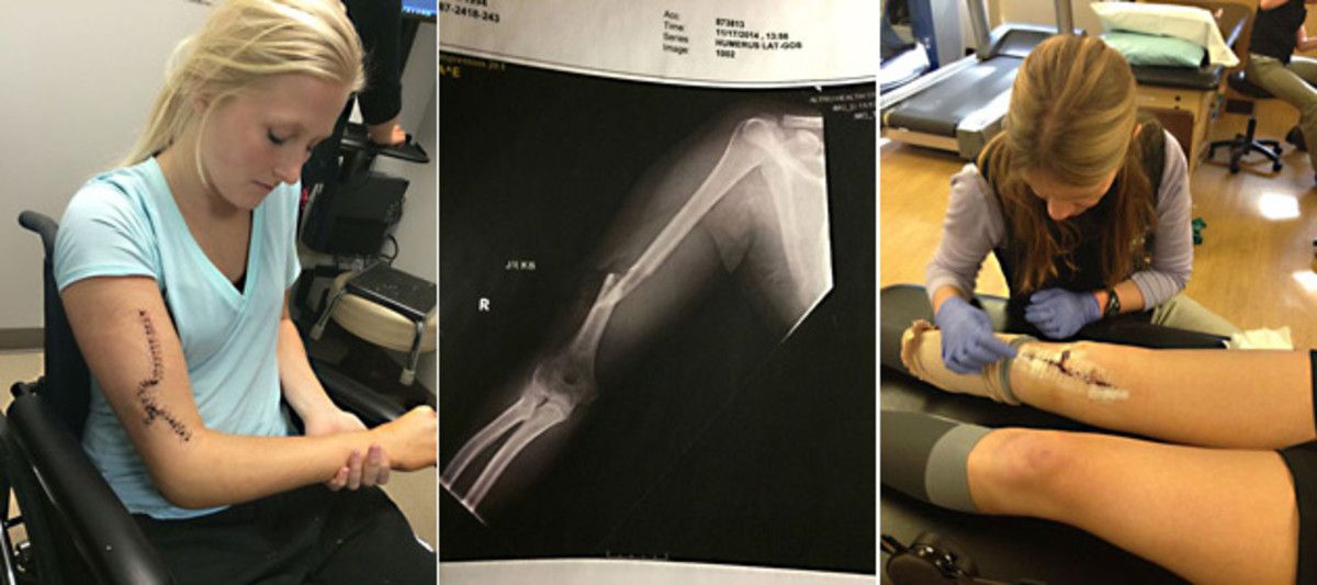 Marvin-injuries-courtesy.jpg